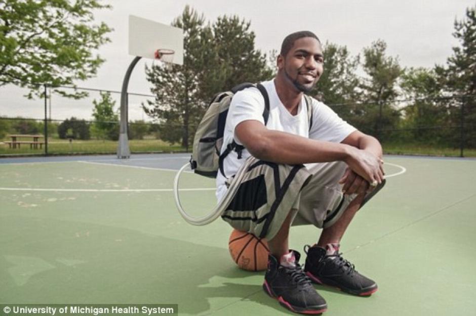 Stan Larkin sobrevivi&oacute; durante 17 meses sin coraz&oacute;n gracias a esta herramienta en la mochila. (Foto: umich.com)