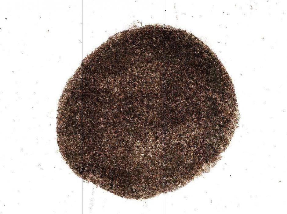 Fotograf&iacute;a facilitada por el Instituto Riken y el Instituto de Investigaci&oacute;n Biom&eacute;dica de Kobe que muestra tejido de retina creado a partir de c&eacute;lulas pluripotentes iPS, Masayo Takahashi, en Tokio, Jap&oacute;n. (Foto: EFE)