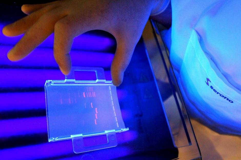 La investigación se centra en los llamados adipocitos, unas células de grasa cutánea, que producen péptidos antimicrobianos (proteínas de origen natural con propiedades antibióticas) que ayudan al cuerpo a combatir bacterias invasoras y otros agentes patógenos. (Foto: EFE/Archivo)