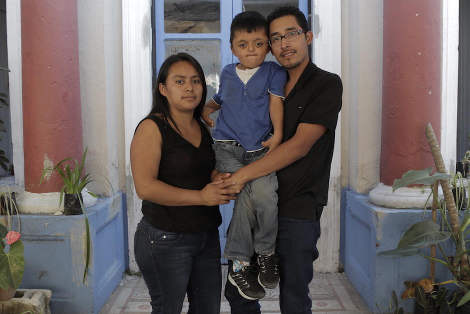 Sa&uacute;l Mart&iacute;nez es un peque&ntilde;o de seis a&ntilde;os con S&iacute;ndrome de Apert con creaneosinostosis. (Foto: Alejandro Bal&aacute;n/Soy502)