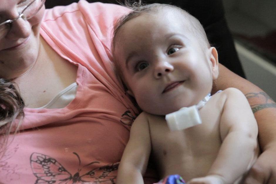 Kaiba es uno de los ni&ntilde;os que no pod&iacute;a respirar con normalidad por la malformaci&oacute;n de los bronquios. (Foto La Prensa)