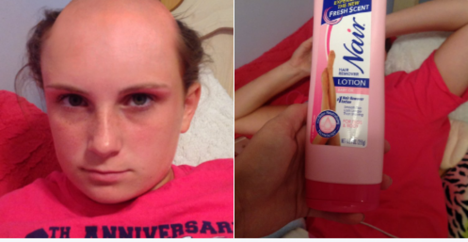 Una adolescente confundi&oacute; el shampoo con crema para depilar se qued&oacute; sin cabello. (Foto: Captura de Imagen)