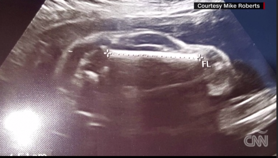 La curiosa imagen que se hace viral en las redes sociales. (Foto: Captura de imagen)