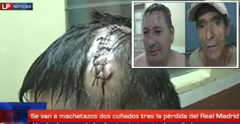Dos cu&ntilde;ados se enfrentan a machetazos por el Real Madrid y el Barcelona en un poblado de Honduras.