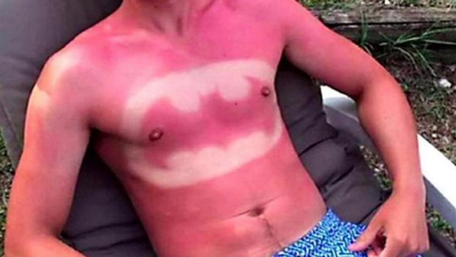 En redes sociales circulan varias im&aacute;genes con tatuajes solares. (Foto: Twitter)