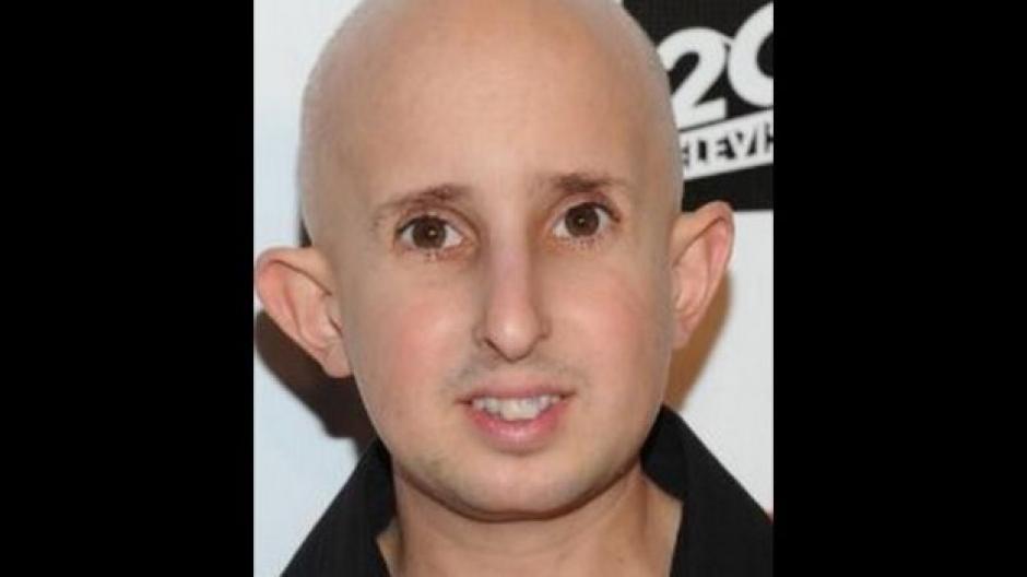 El actor falleci&oacute; en un hospital de Los &Aacute;ngeles luego de sufrir un accidente la semana pasada. (Foto: Internet)