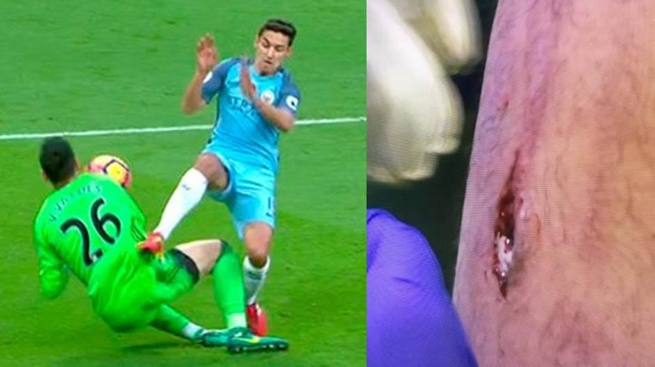 Jes&uacute;s Navas fue por todo frente a Victor Vald&eacute;s que se llev&oacute; la peor parte. (Foto: Twitter)