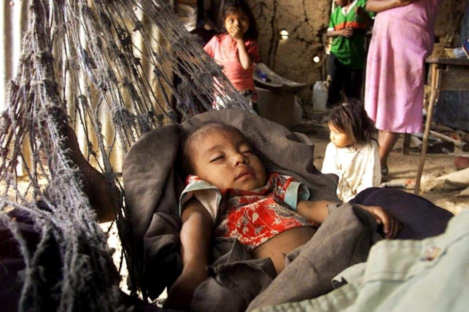 En un a&ntilde;o, seg&uacute;n la Sesan, Guatemala logr&oacute; disminuir un 1.7% en la desnutrici&oacute;n cr&oacute;nica y un 4.5% la anemia en menores de cinco a&ntilde;os. (Foto: Infanciahoy.com)