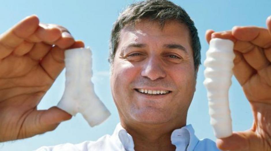 Paolo Macchiarini est&eacute; envuelto en casos de corrupci&oacute;n.  (Foto: AFP)