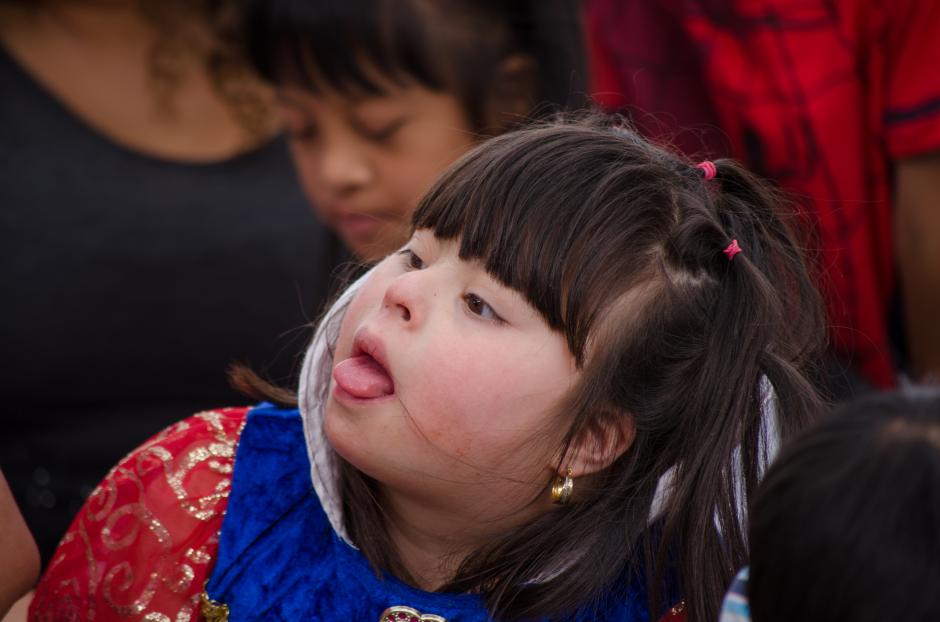 El s&iacute;ndrome de Down es una combinaci&oacute;n cromos&oacute;mica &nbsp;que siempre ha formado parte de la condici&oacute;n humana, existe en todas las regiones del mundo y habitualmente tiene efectos variables. (Marcelo Jim&eacute;nez/Soy502)