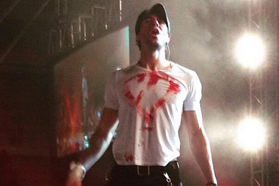 A pesar de las recomendaciones de que suspendiera la actuaci&oacute;n tras el accidente, Iglesias decidi&oacute; volver al escenario para terminar el concierto.