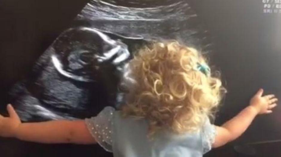 La tierna ni&ntilde;a empez&oacute; a abrazar la imagen de su hermana y a llorar de emoci&oacute;n por verla. (Foto: Facebook)