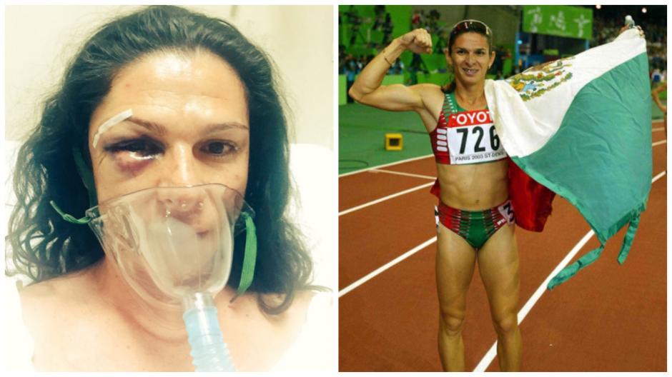 Por fortuna est&aacute; ya en recuperaci&oacute;n, aunque s&iacute; necesito tratamiento m&eacute;dico urgente. (Fotos: Twitter)