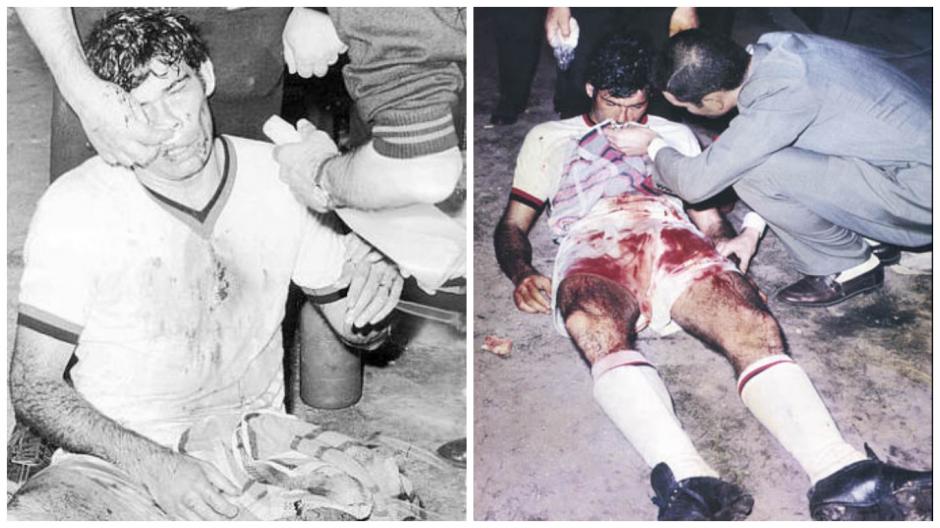 Al pobre Nestor Combin le rompieron la nariz. (Foto: Wikipedia)