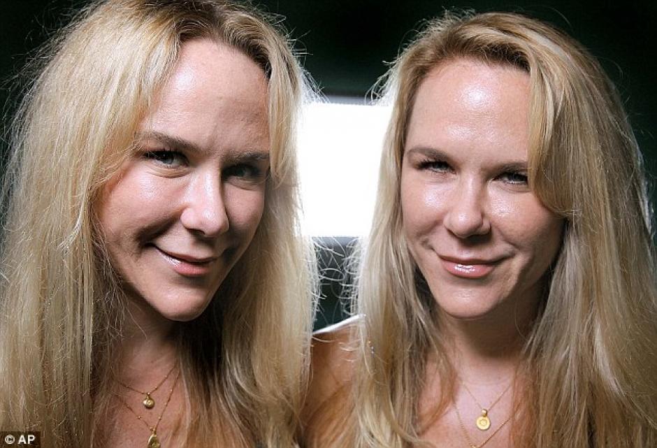 Seg&uacute;n testigos, las gemelas discut&iacute;an al momento del percance. (Foto: Daily Mail)