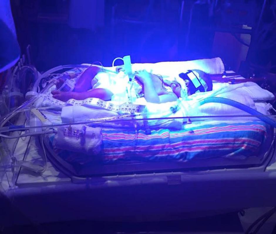 Los usuarios de redes sociales se conmovieron con una fotograf&iacute;a, en la que un reci&eacute;n nacido, llamado Mason abraza a su hermanito Hawk, quien estaba conectado a un respirador artificial. (Foto: Facebook/Mason &amp; Hawk)