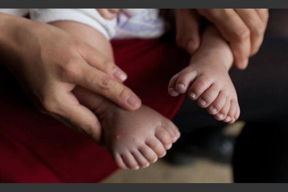 El ni&ntilde;o naci&oacute; en enero y sorprendi&oacute; a los doctores. (Foto: CNN en Espa&ntilde;ol)
