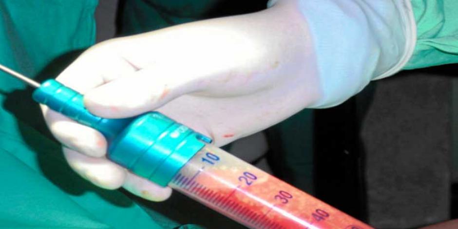 El cirujano extrajo 8.2 litros de grasa. (Foto: dmedicina.com)