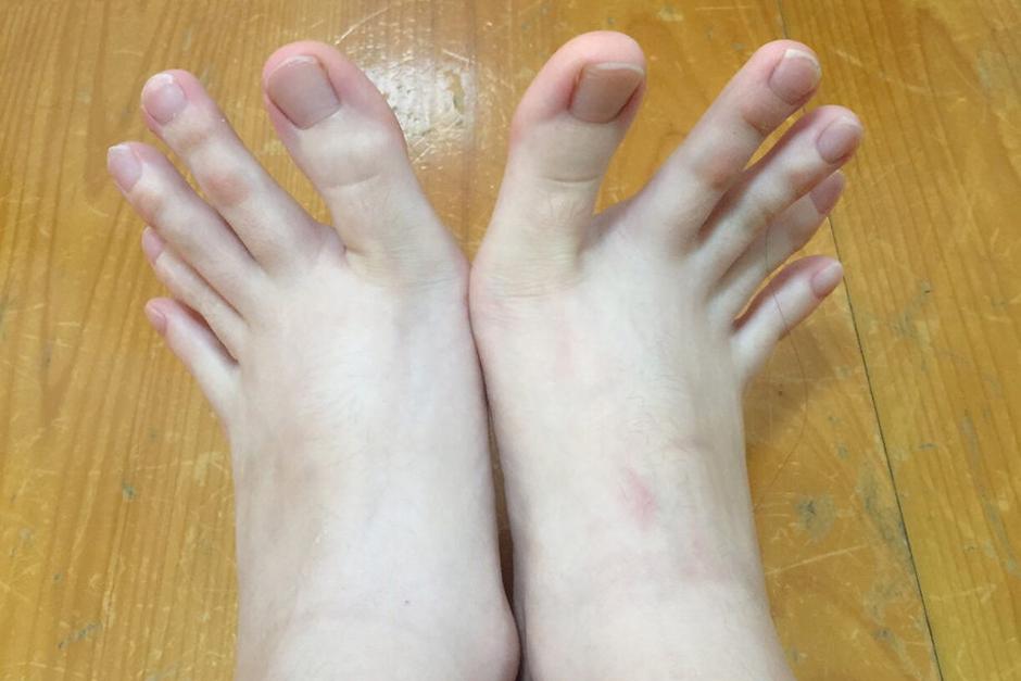 Una joven taiwanesa sorprendi&oacute; al mundo con la forma de sus pies. (Foto: dcard.tw)
