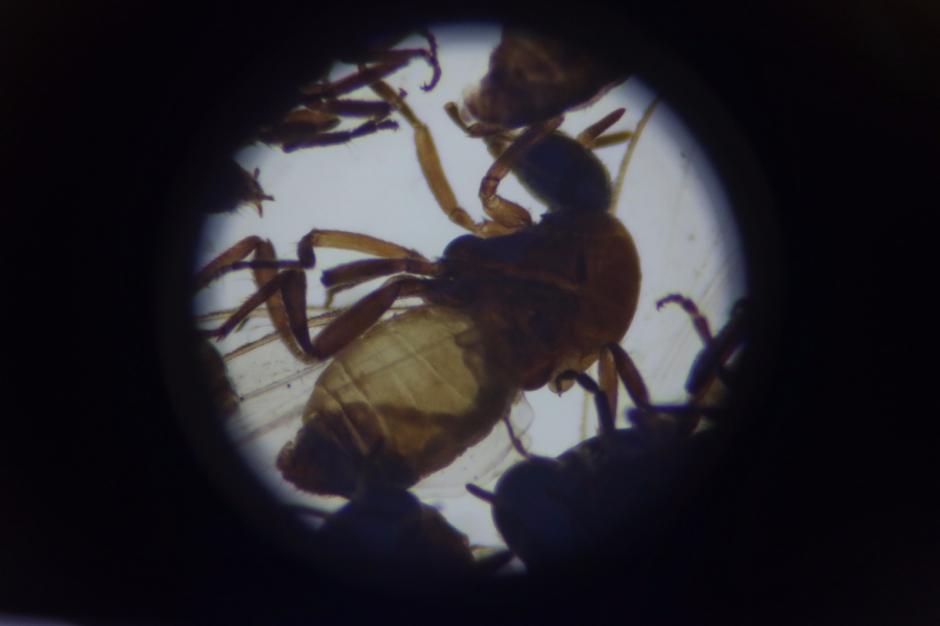 La larva de la oncocercosis puede provocar ceguera. (Foto: Alejandro Bal&aacute;n/Soy502)