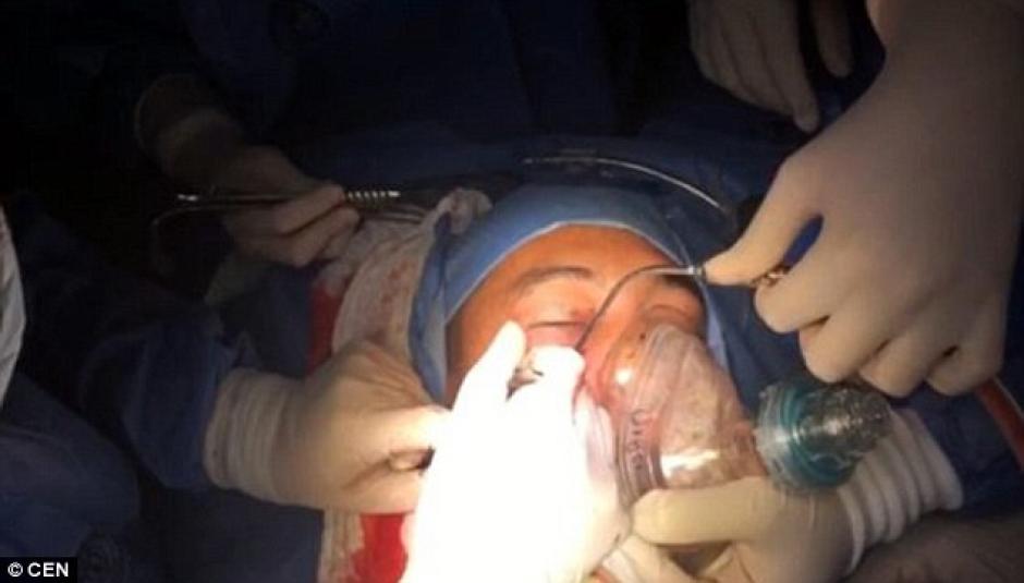 El incidente tuvo lugar en Colombia. (Foto: Daily Mail)