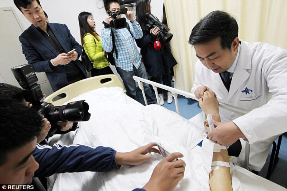 El doctor Guo Shuzhong, us&oacute; el cart&iacute;lago de las costillas del hombre para construir la nueva oreja. (Foto: DailyMail)
