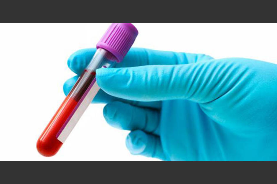 Nueva tecnolog&iacute;a permite identificar todos los virus que han afectado a una persona con un &uacute;nico an&aacute;lisis y por un precio aproximado de 25 d&oacute;lares. (Foto: www.elfortindeguayana.com)