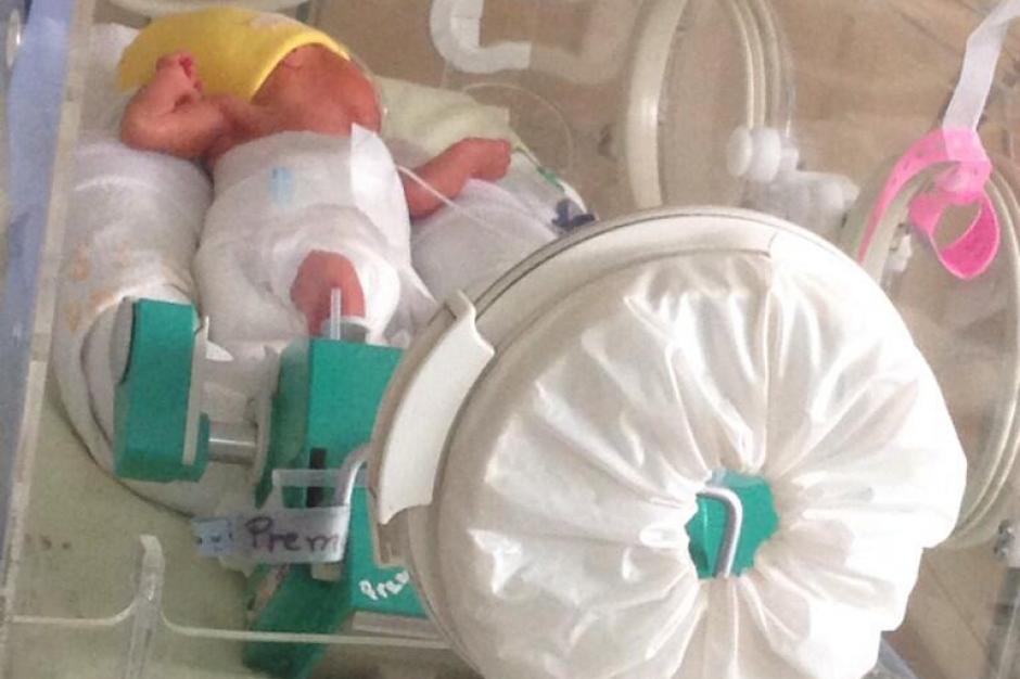 La segunda beb&eacute; en nacer de los quintillizos nacidos el viernes ya sali&oacute; del &aacute;rea de alto riesgo. &nbsp;(Foto: IGSS)
