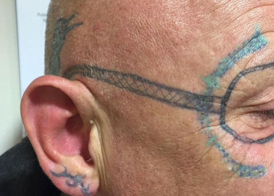 Luego de asistir a una fiesta y en total estado et&iacute;lico, este hombre amaneci&oacute; con un tatuaje en la cara sin recordar hab&eacute;rselo hecho. (Foto.&nbsp;dailymail.co.uk)