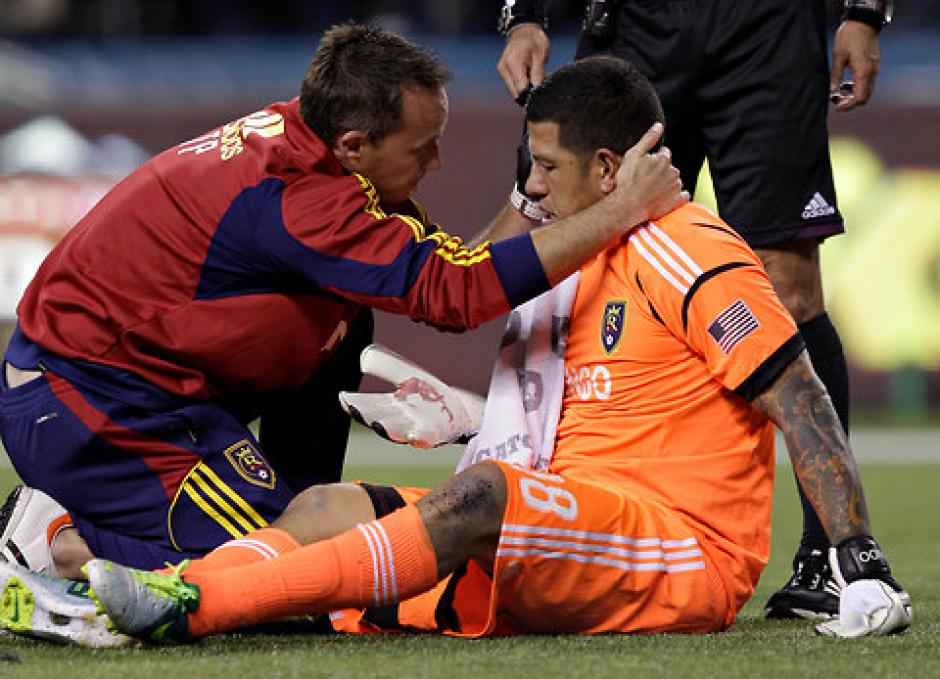 Uno de los porteros de la selecci&oacute;n de futbol de los Estados Unidos, Nick Rimando, sufri&oacute; una dura lesi&oacute;n en una de sus manos. (Foto: Archivo)