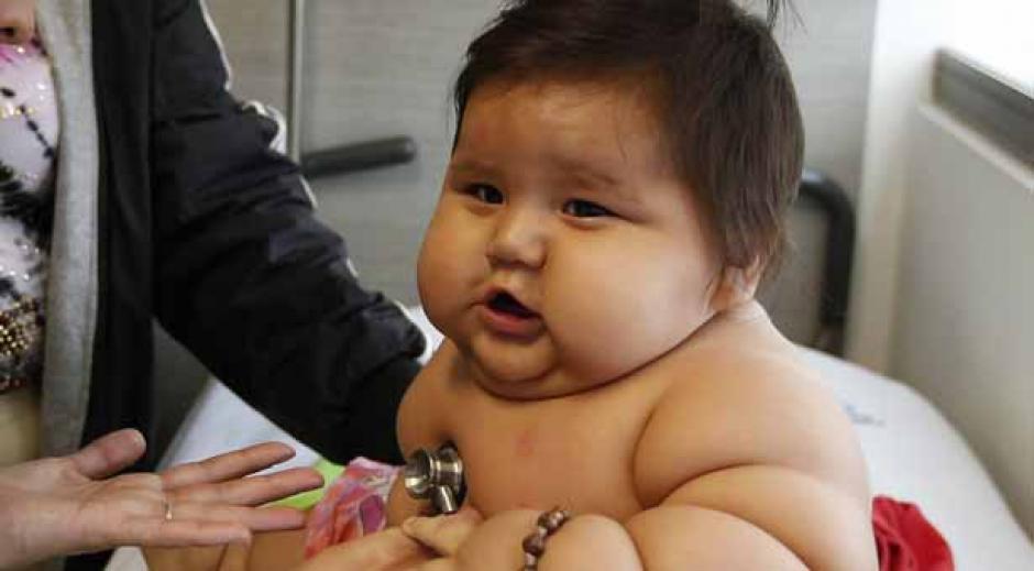 Estad&iacute;sticas de la Organizaci&oacute;n Mundial para la Salud (OMS) se&ntilde;alan que la prevalencia de obesidad infantil aumenta aceleradamente en las zonas m&aacute;s pobres y comunidades ind&iacute;genas de la regi&oacute;n. (Foto: Archivo)