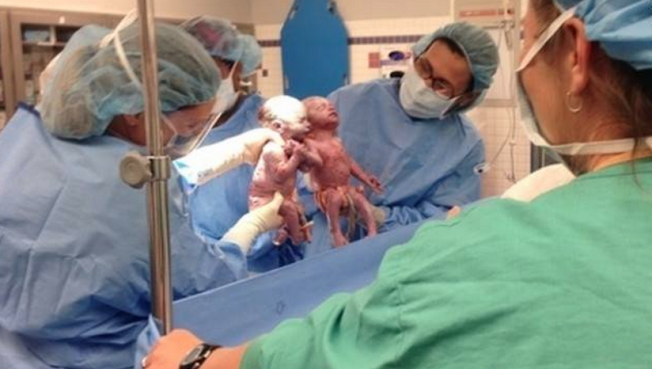 Las gemelas nacidas el 10 de mayo cuando se celebra el d&iacute;a de la Madre, nacieron tomadas de la mano. (Foto:CNN)&nbsp;