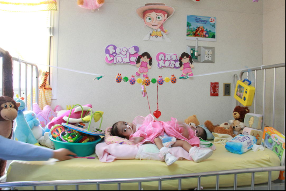 Las siamesas conocidas como "Las Rositas", podr&iacute;an ser separadas el pr&oacute;ximo 16 de septiembre. (Foto Archivo: Jes&uacute;s Alfonso/Soy502)