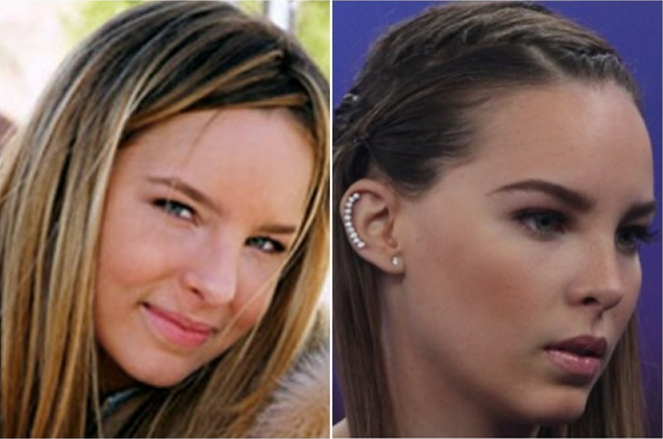 El primer cuadro muestra a Belinda en un antes y después de una rinoplastia. (Foto: El Espectador)