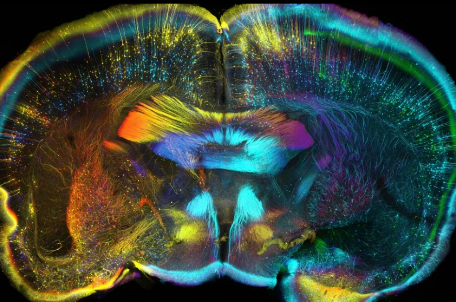 Cerebro de un rat&oacute;n (Luis de la Torre-Ubieta, UCLA / Wellcome Images)
