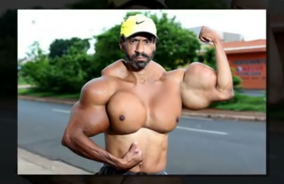 Valdir Segato quiere que sus b&iacute;ceps lleguen a medir 68 cent&iacute;metros, por lo que se inyecta aceite. (Imagen: Captura de pantalla)