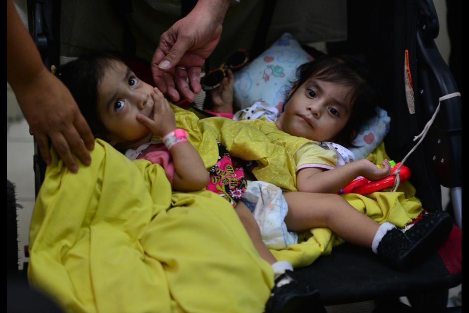 Ya han transcurrido 6 horas de la operaci&oacute;n de Las Rositas, se espera que en poco tiempo sean separadas y trasladadas a quir&oacute;fanos distintos para la reconstrucci&oacute;n de sus &oacute;rganos. (Foto: Archivo/Soy502)