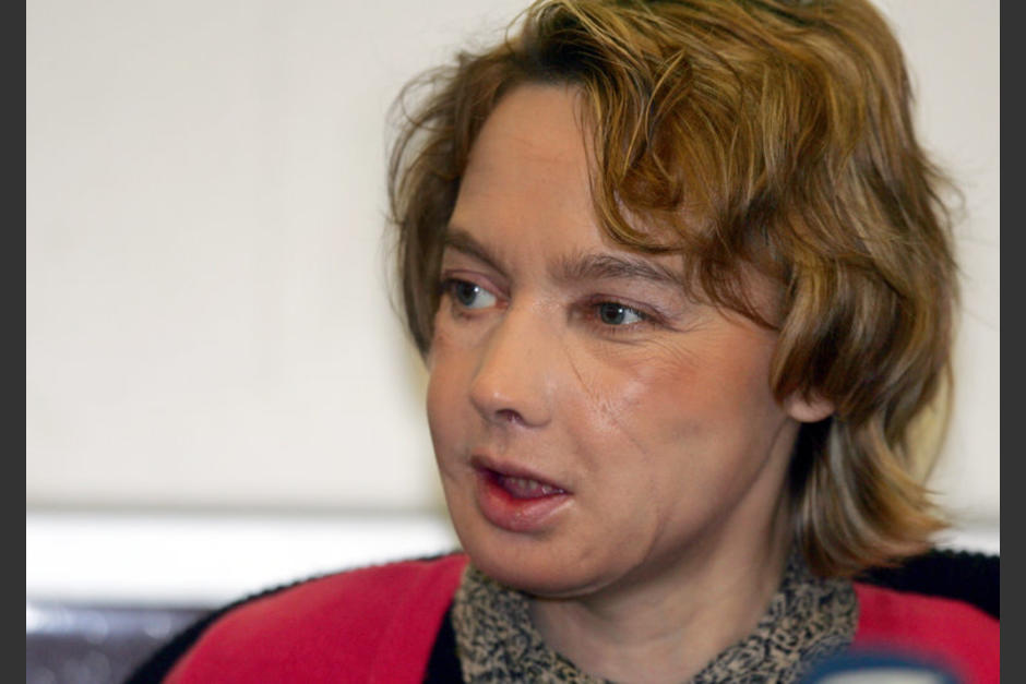 Isabelle Dinoire fue intervenida en noviembre de 2005 luego de ser atacada por su perra. (Foto: nytimes.cpm)