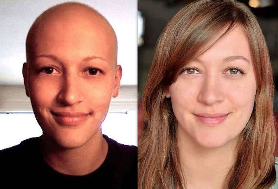 Erin Chack se liber&oacute; del linfoma de Hodgkin hace 5 a&ntilde;os. (Foto: Erin Chack)&nbsp;