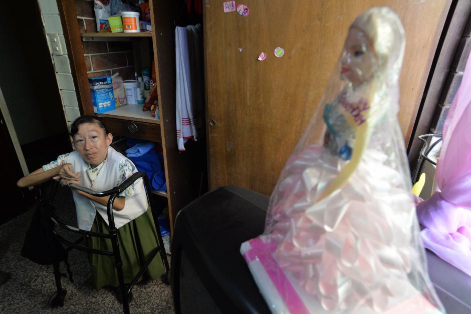 Claudia Paola Garc&iacute;a tiene 40 a&ntilde;os y naci&oacute; con deformidades cong&eacute;nitas. (Foto: Wilder L&oacute;pez/Soy502)