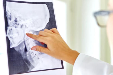 Descubren Un Posible Nuevo Organo En La Garganta Humana