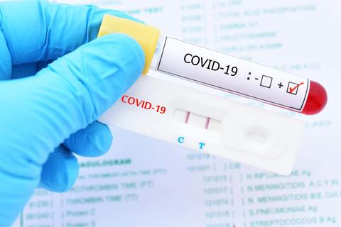 ¿Cómo saber si nunca te has contagiado de Covid-19?