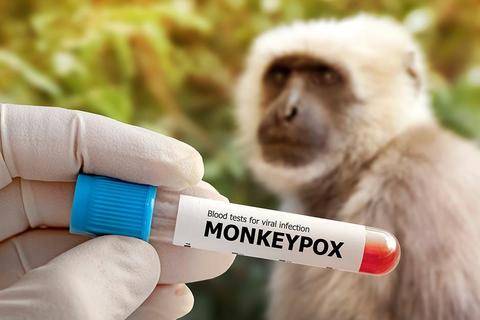 Esta es la prueba que se realiza para detectar la viruela del mono