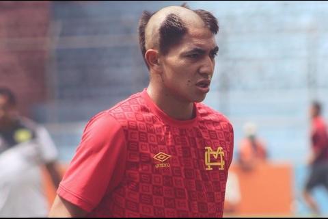 El debutante de Municipal que llamó la atención por su peculiar corte de pelo