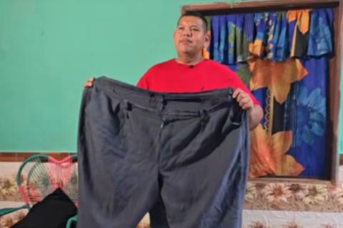 Elder Castillo, considerado 'el hombre m&aacute;s obeso de Guatemala', se transforma