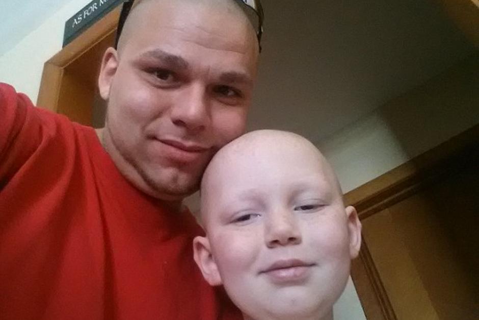 Padre se tat&uacute;a cicatriz en homenaje a su hijo sobreviviente de c&aacute;ncer