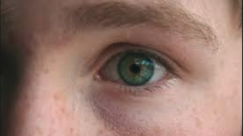 Estas enfermedades se pueden reflejar en tus ojos