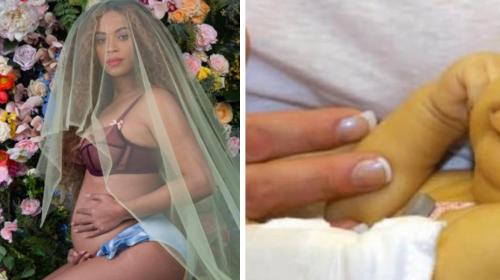 Conoce la enfermedad que afecta a los gemelos de Beyonc&eacute;