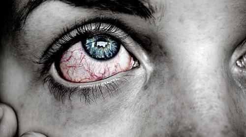 Razones por las que se te ponen rojos los ojos