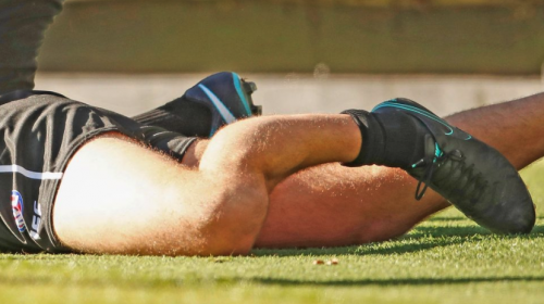 Escalofriante lesi&oacute;n al chocar con un poste en pleno partido